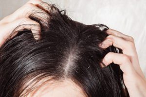 Moroccan Legacy |Argan Oil for dry scalp and dandruff